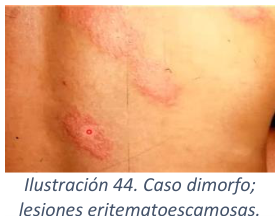 Adjuntos/U03_p38_fig02.png