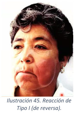 Adjuntos/U03_p38_fig03.png