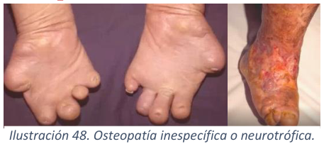 Adjuntos/U03_p39_fig03.png