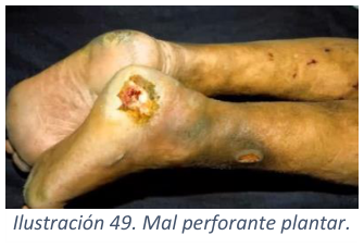 Adjuntos/U03_p39_fig04.png