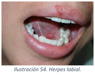 Adjuntos/U04_p43_fig02.png