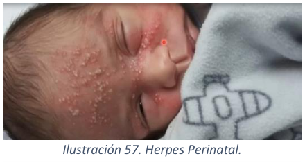 Adjuntos/U04_p43_fig05.png