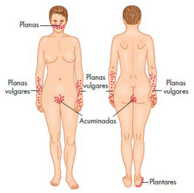 Adjuntos/U04_p48_fig03.png