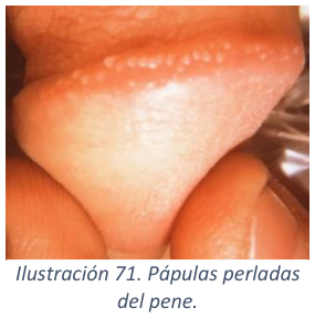 Adjuntos/U04_p50_fig03.png