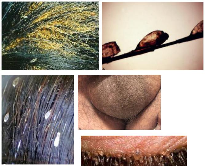 Adjuntos/U05_p24_fig01.png