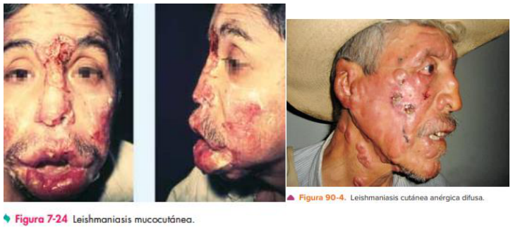 Adjuntos/U05_p25_fig03.png