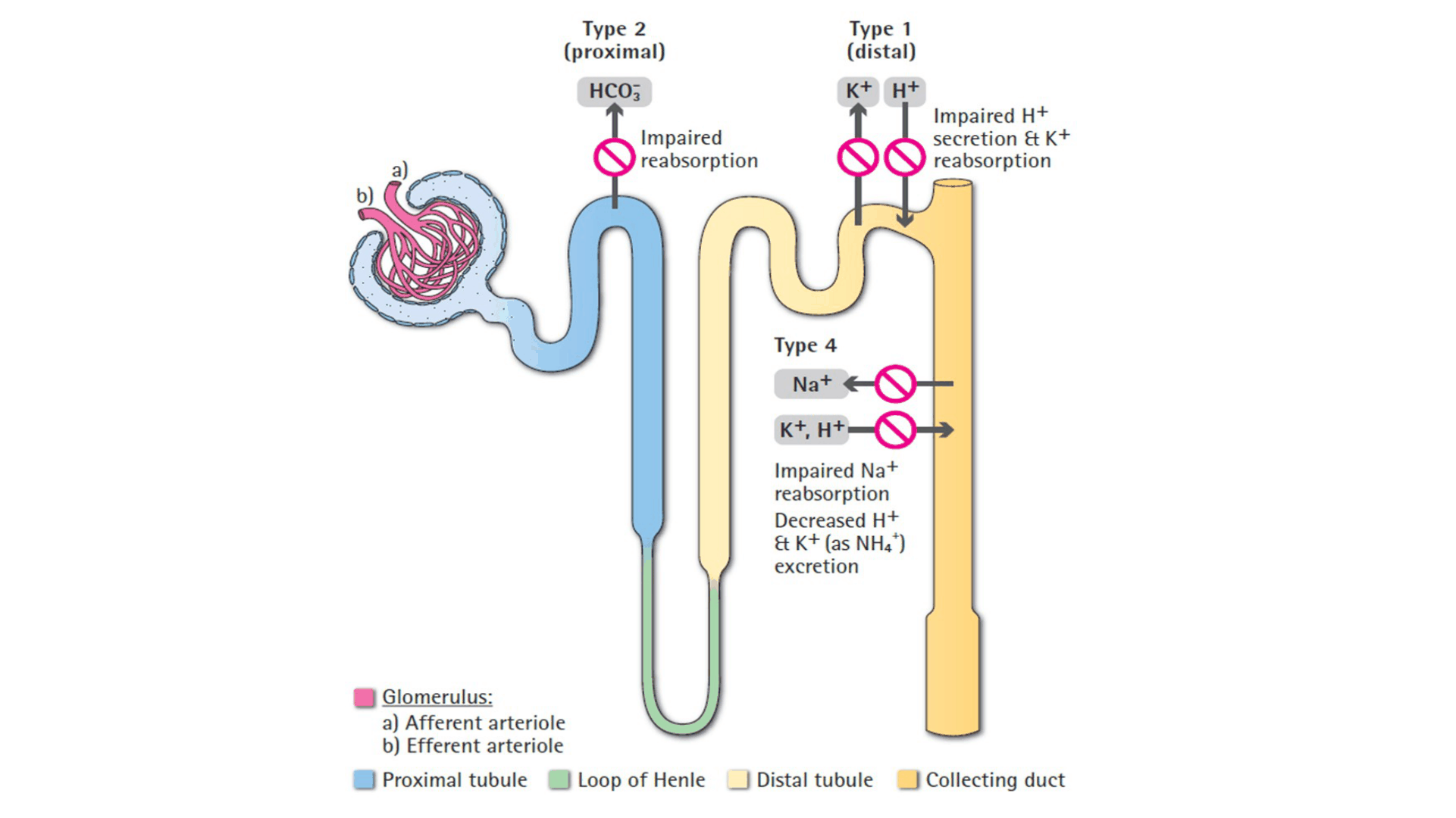 ACIDOSIS_METABOLICA_D25.png