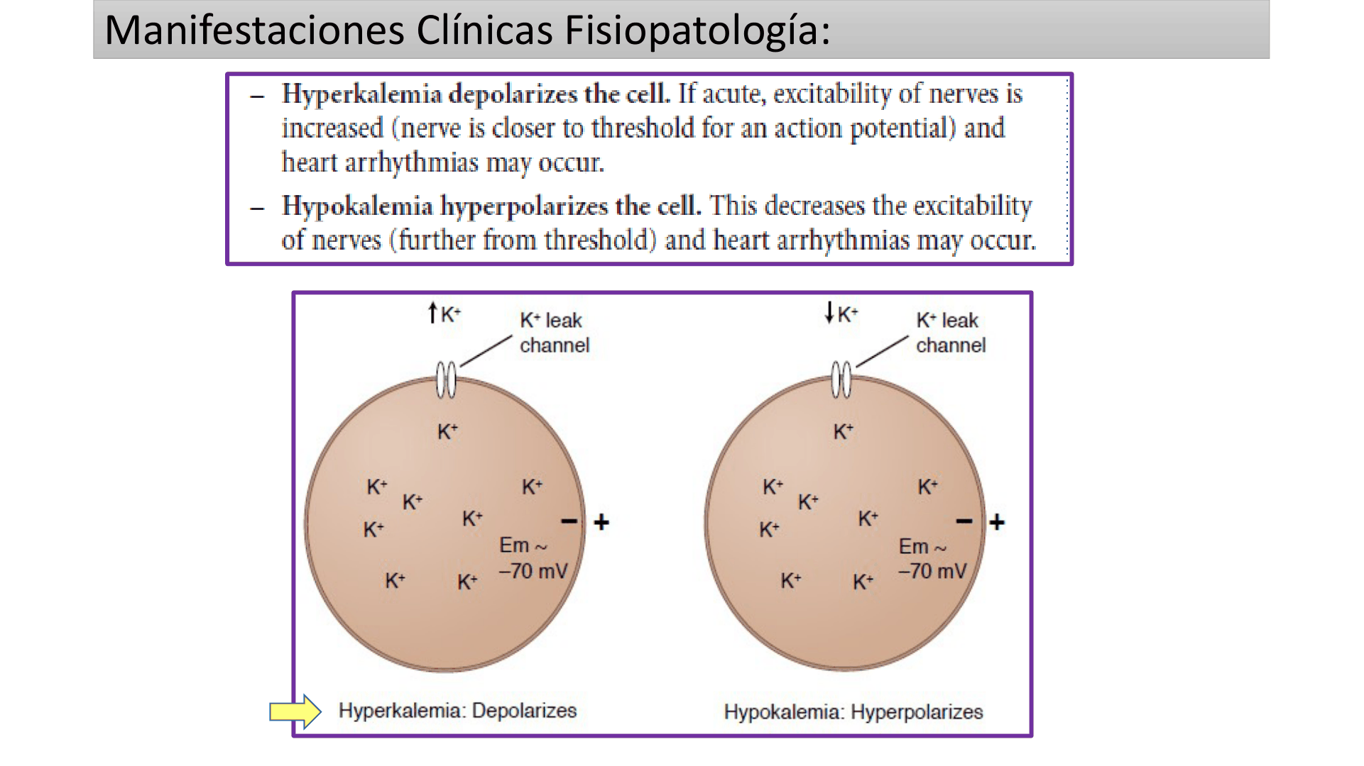HIPERCALEMIA_D07.png