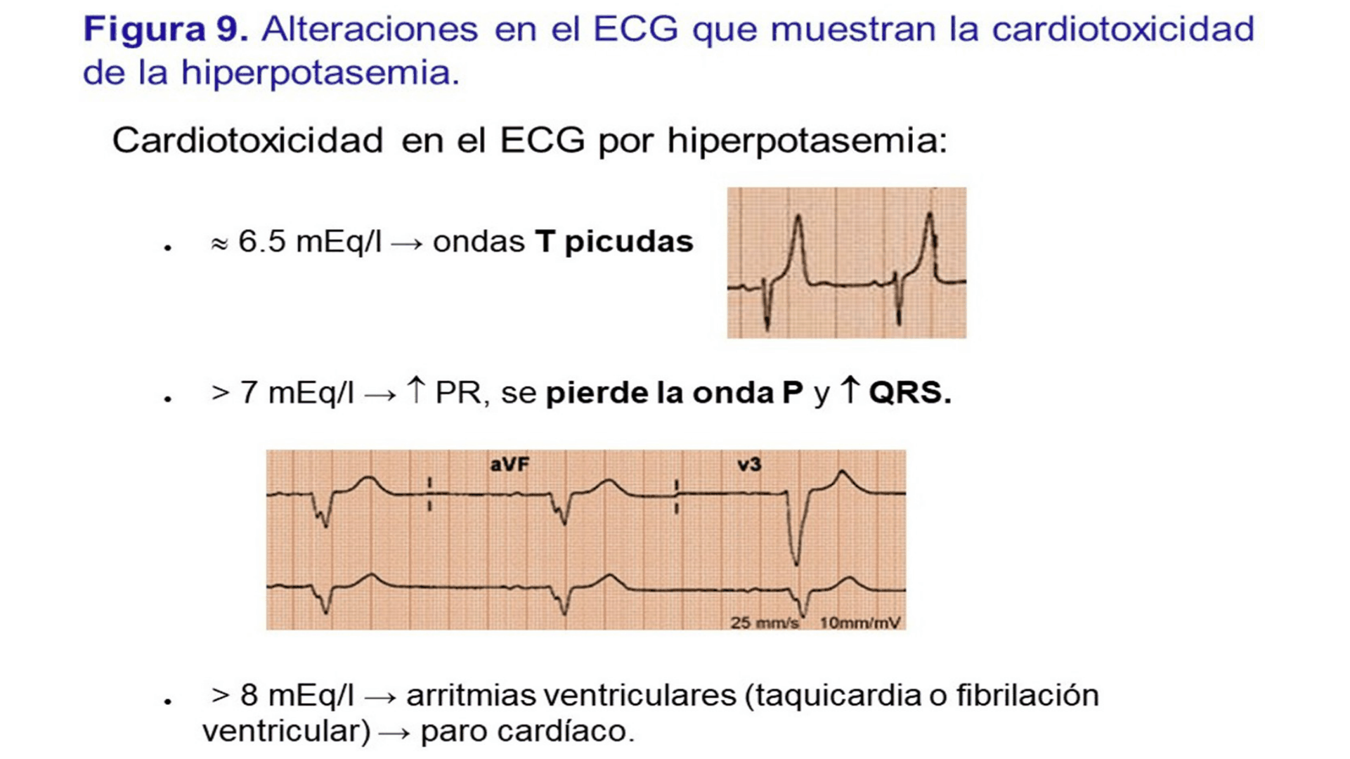 HIPERCALEMIA_D11.png