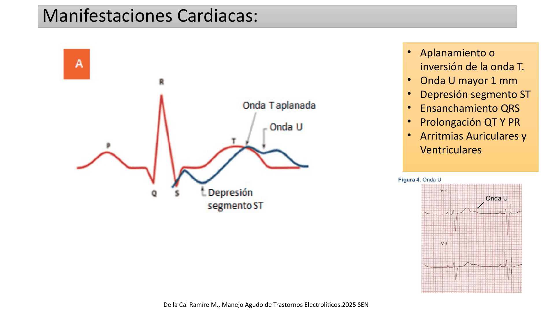 HIPOCALEMIA_D16.png