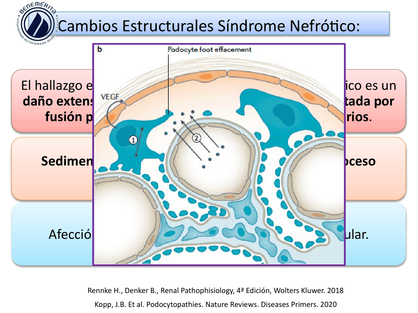 SINDROMESGLOMERULARESUAA_D10.png