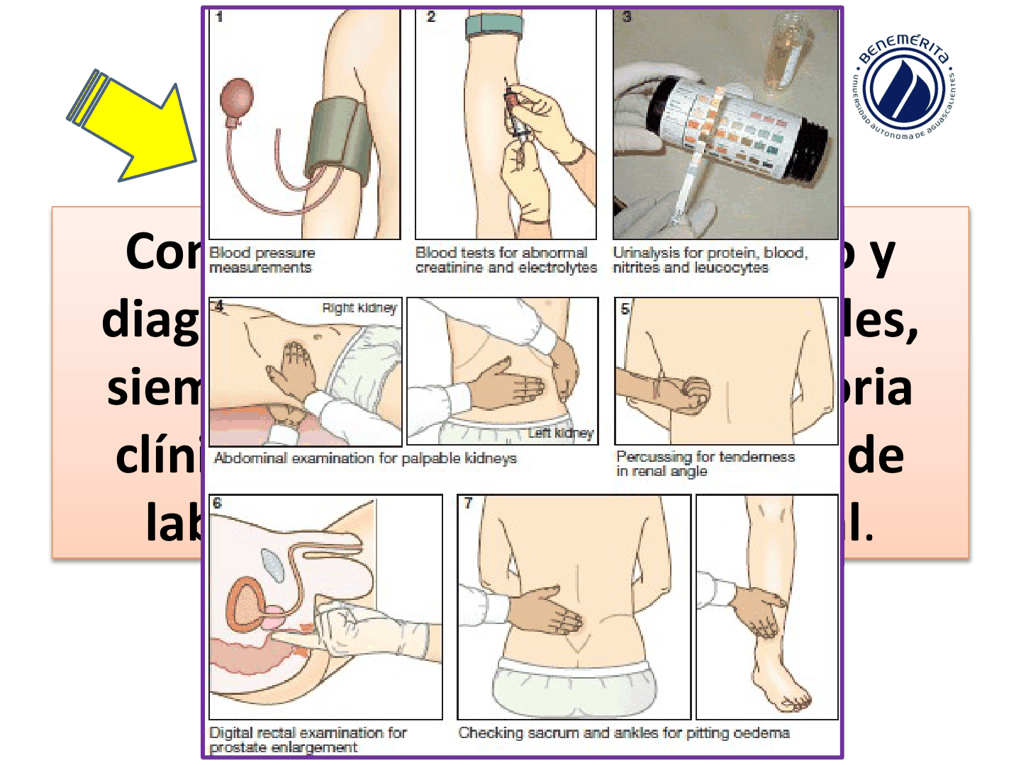 SINDROMESGLOMERULARESUAA_D15.png