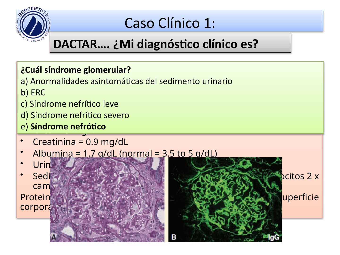 SINDROMESGLOMERULARESUAA_D26.png