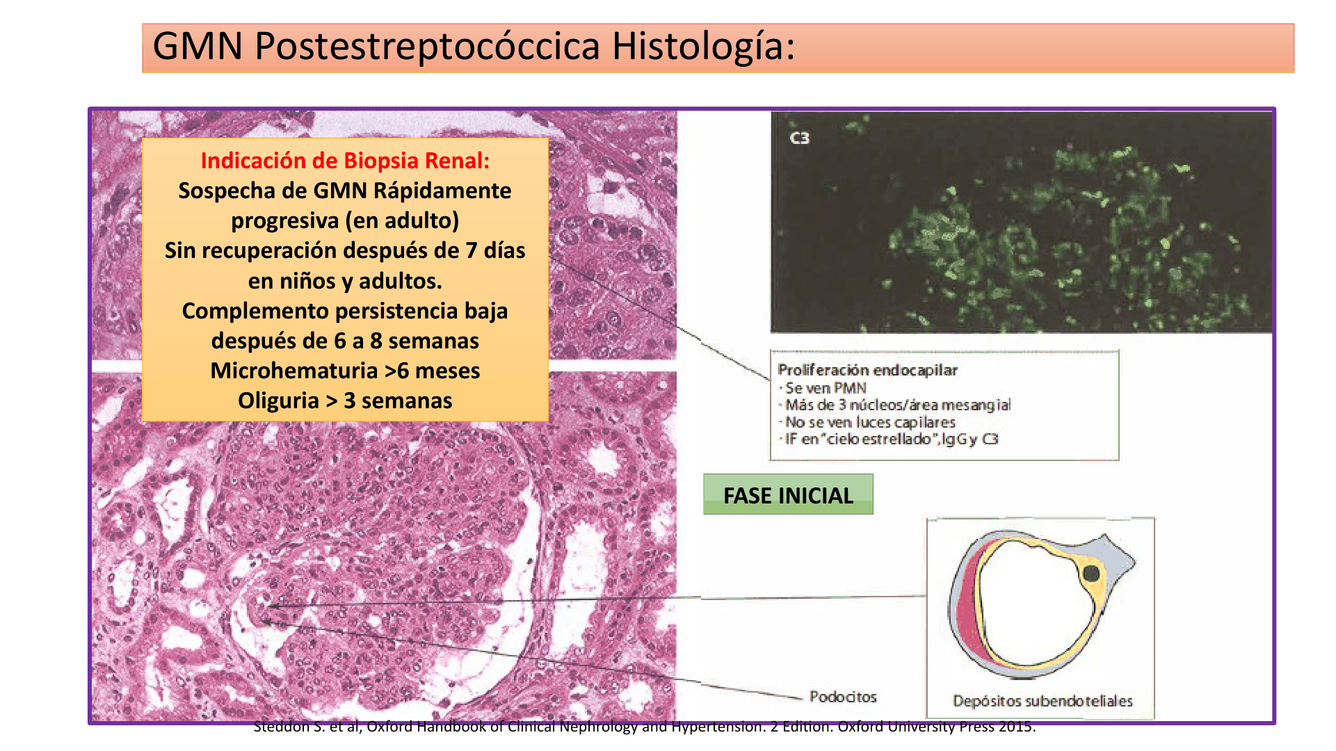 SINDROME_NEFRITICO_D15.png