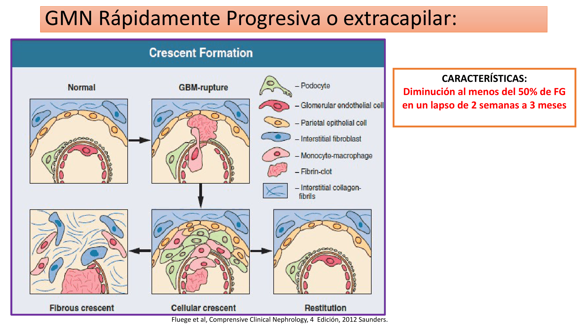 SINDROME_NEFRITICO_D27.png