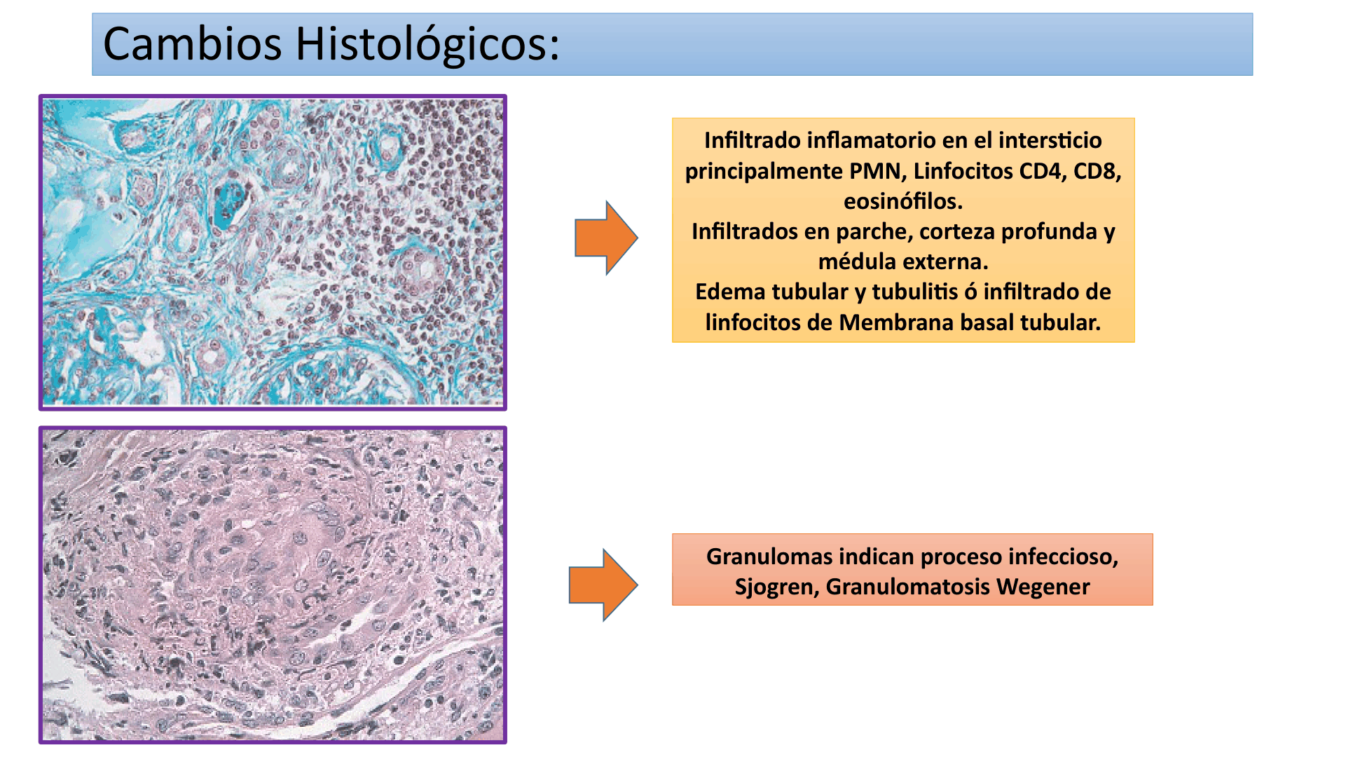 TUBULOINTERSTICIALES_D11.png