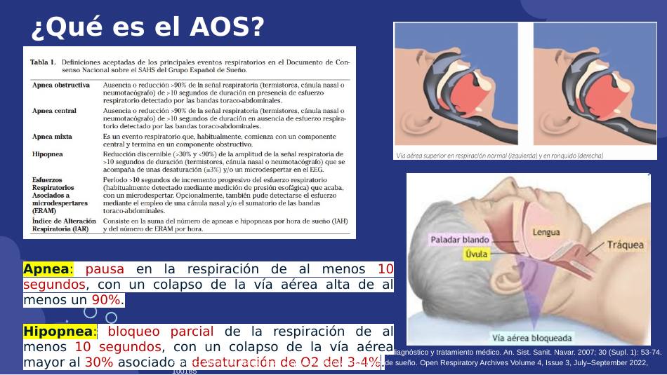 apnea-sueno_s03.jpg800
