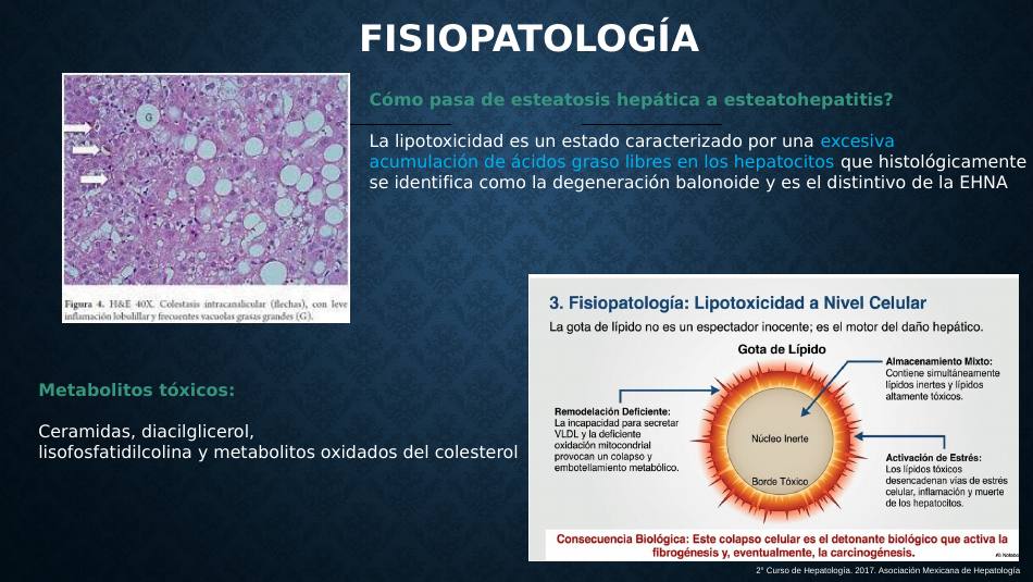 higado-graso-masld_s08.jpg800