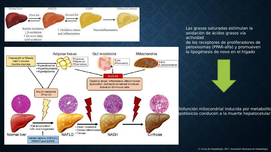 higado-graso-masld_s09.jpg800