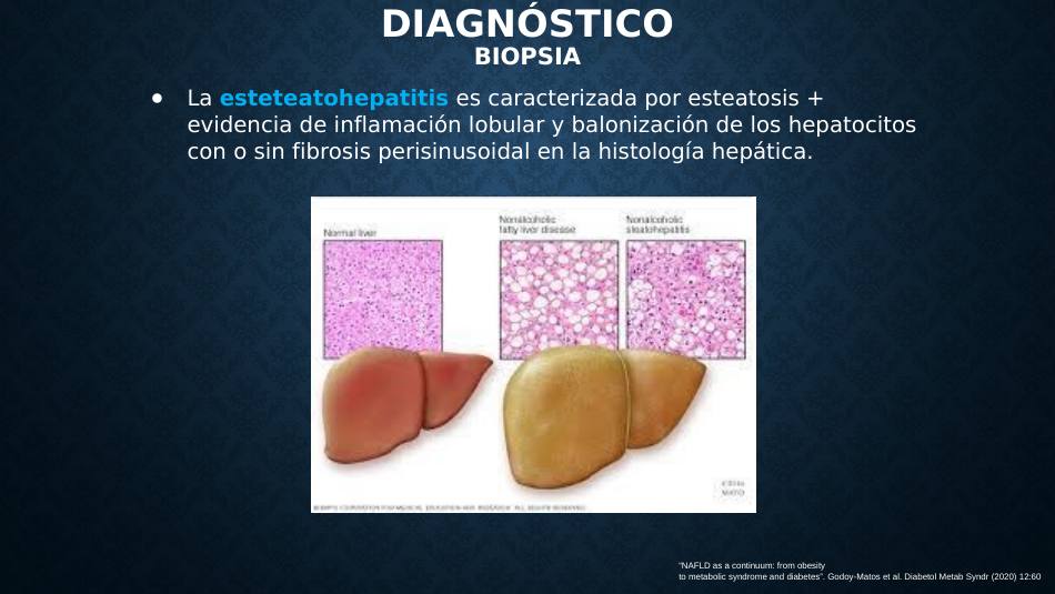 higado-graso-masld_s16.jpg800