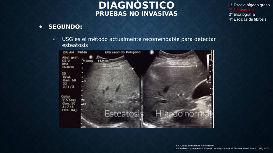 higado-graso-masld_s20.jpg800
