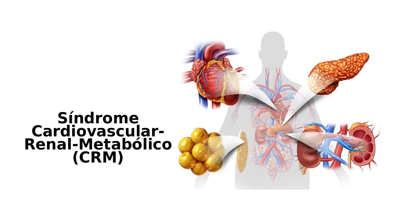 sindrome-crm_s01.jpg800